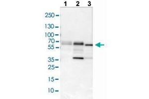 Western blot analysis of Lane 1: NIH/3T3 cell lysate, Lane 2: NBT-II cell lysate, and Lane 3: PC-12 cell lysate with PDCD4 polyclonal antibody . (PDCD4 抗体  (AA 230-330))
