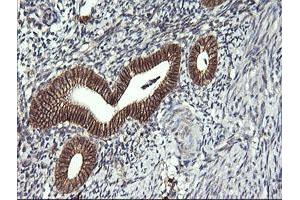 Immunohistochemistry (IHC) image for anti-T-cell surface glycoprotein CD1c (CD1C) antibody (ABIN2670676) (CD1c 抗体)