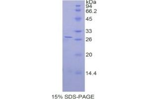 SDS-PAGE of Protein Standard from the Kit (Highly purified E. (ADRP ELISA 试剂盒)