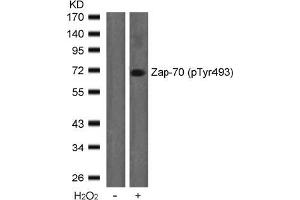 Image no. 2 for anti-zeta-Chain (TCR) Associated Protein Kinase 70kDa (ZAP70) (pTyr493) antibody (ABIN196887) (ZAP70 抗体  (pTyr493))
