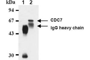 Western Blotting (WB) image for anti-Cell Division Cycle 7 (CDC7) antibody (ABIN487481) (CDC7 抗体)