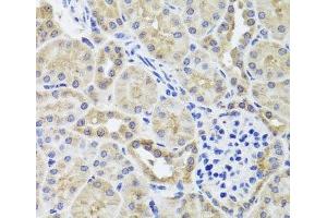 Immunohistochemistry of paraffin-embedded Mouse kidney using CGB7 Polyclonal Antibody at dilution of 1:100 (40x lens). (CGB7 抗体)