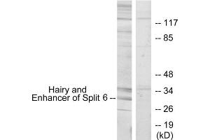 Western blot analysis of extracts from HeLa cells, using HES6 antibody. (HES6 抗体  (N-Term))