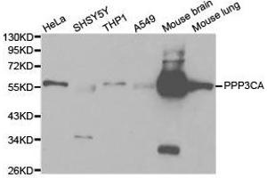 Western Blotting (WB) image for anti-Protein Phosphatase 3, Catalytic Subunit, alpha Isoform (PPP3CA) antibody (ABIN1874232)