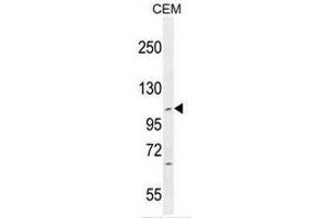 IFT88 Antibody (IFT88 抗体  (C-Term))