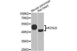 Western blot analysis of extracts of various cell lines, using KCNJ5 Antibody (ABIN1882359) at 1:1000 dilution. (KCNJ5 抗体)