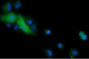 Image no. 3 for anti-Cancer/testis Antigen 1B (CTAG1B) antibody (ABIN1499891) (CTAG1B 抗体)