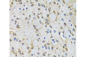 Immunohistochemistry of paraffin-embedded Rat brain using HTR2B Polyclonal Antibody at dilution of 1:100 (40x lens).