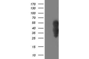 Western Blotting (WB) image for anti-WW Domain Containing Transcription Regulator 1 (WWTR1) antibody (ABIN1501762) (WWTR1 抗体)