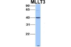 Host:  Rabbit  Target Name:  MLLT3  Sample Type:  Hela  Antibody Dilution:  1. (AF9 抗体  (C-Term))