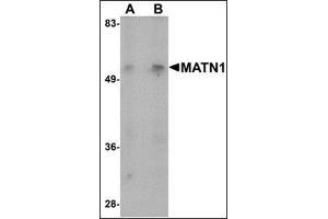 Western blot analysis of MATN1 in mouse liver tissue lysate with this product at (A) 1 and (B) 2 μg/ml. (MATN1 抗体  (N-Term))
