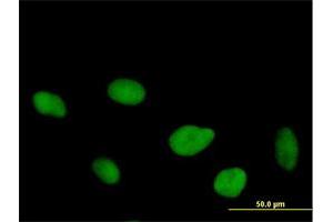 Immunofluorescence of purified MaxPab antibody to FLJ10826 on HeLa cell. (OGFOD1 抗体  (AA 1-542))
