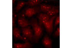 U2-OS cells stimulated with tetradecanoylphorbol acetate and treated with MEK and p38 inhibitors were stained with anti-Bmi1 followed by Goat Anti-Mouse Ig, Human ads-TXRD (山羊 anti-小鼠 Ig (Heavy & Light Chain) Antibody (Texas Red (TR)))