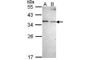 WB Image Sample (30 ug of whole cell lysate) A: A431 , B: H1299 12% SDS PAGE antibody diluted at 1:1000 (NOSIP 抗体)