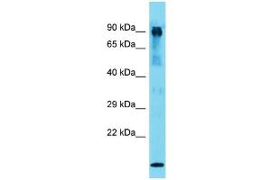 Host: Rabbit  Target Name: Mut  Sample Tissue: Mouse Muscle lysates  Antibody Dilution: 1. (MUT 抗体  (N-Term))