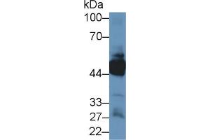 Western blot analysis of Human Lung lysate, using Human KRT33A Antibody (1 µg/ml) and HRP-conjugated Goat Anti-Rabbit antibody ( (Keratin 33A 抗体  (AA 57-363))
