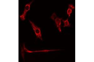 ABIN6274774 staining HuvEc cells by IF/ICC. (RPL26L1 抗体  (C-Term))