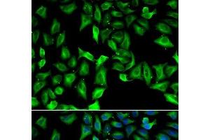 Immunofluorescence analysis of A549 cells using GDA Polyclonal Antibody (GDA 抗体)