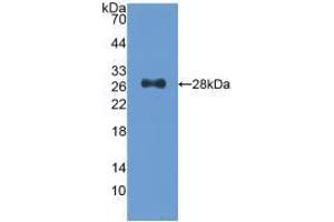 Western blot analysis of recombinant Human CDK9. (CDK9 抗体  (AA 104-315))