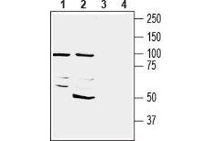 Western Blotting (WB) image for anti-5'-Nucleotidase, Ecto (CD73) (NT5E) (AA 429-433), (Extracellular) antibody (ABIN7042877)