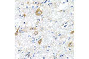 Immunohistochemistry of paraffin-embedded rat brain using NRG4 antibody at dilution of 1:100 (40x lens). (Neuregulin 4 抗体)