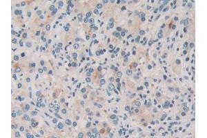 Immunohistochemistry (IHC) image for anti-Torsin Family 1, Member A (Torsin A) (TOR1A) (AA 33-321) antibody (ABIN7443317)