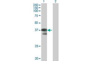 Western Blot analysis of C2orf3 expression in transfected 293T cell line by C2orf3 MaxPab polyclonal antibody. (GCFC2 抗体  (AA 1-215))