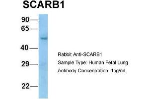 Host: Rabbit  Target Name: SCARB1  Sample Tissue: Human Fetal Lung  Antibody Dilution: 1. (SCARB1 抗体  (N-Term))