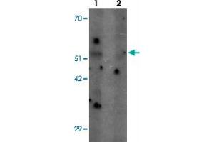 Western blot analysis of SHQ1 in human heart tissue with SHQ1 polyclonal antibody  at 1 ug/mL in (1) the absence and (2) the presence of blocking peptide. (SHQ1 抗体  (N-Term))