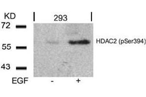 Image no. 3 for anti-Histone Deacetylase 2 (HDAC2) (pSer394) antibody (ABIN319237) (HDAC2 抗体  (pSer394))