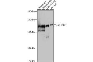 Western blot analysis of extracts of various cell lines, using CL antibody (ABIN1679249, ABIN3019015, ABIN3019016 and ABIN6220674) at 1:1000 dilution. (CLASP2 抗体  (AA 220-400))