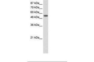 Image no. 1 for anti-Tyrosyl-tRNA Synthetase (Yars) (AA 451-500) antibody (ABIN202719) (YARS 抗体  (AA 451-500))