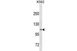 Western Blotting (WB) image for anti-Calsyntenin 2 (CLSTN2) antibody (ABIN3001117) (Calsyntenin 2 抗体)