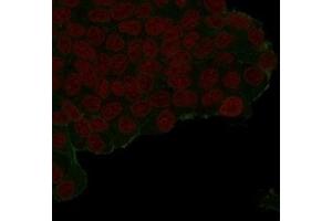 IF Analysis of transfected PFA-fixed MCF7 cells labeling HA-recombinant protein. (HA-Tag 抗体)