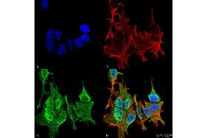 Immunocytochemistry/Immunofluorescence analysis using Mouse Anti-Ankyrin B Monoclonal Antibody, Clone S105-13 . (ANK2 抗体  (AA 203-496) (FITC))