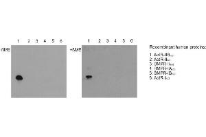 Western blot with extracellular domains (ecd) of different related human receptors (50ng per lane) reveals that anti-Activin Receptor IIB, pAb (IG-510)  (dilution 1:5000) specifically recoginzes ACTR-IIB under nonreducing (-ßME, left panel) and reducing (+ßME; right panel) conditions, but none of the other receptor types tested. (ACVR2B 抗体  (Extracellular Domain))