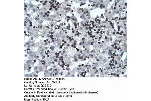Immunohistochemistry (IHC) image for anti-SWI/SNF Related, Matrix Associated, Actin Dependent Regulator of Chromatin, Subfamily B, Member 1 (SMARCB1) (N-Term) antibody (ABIN2778301)