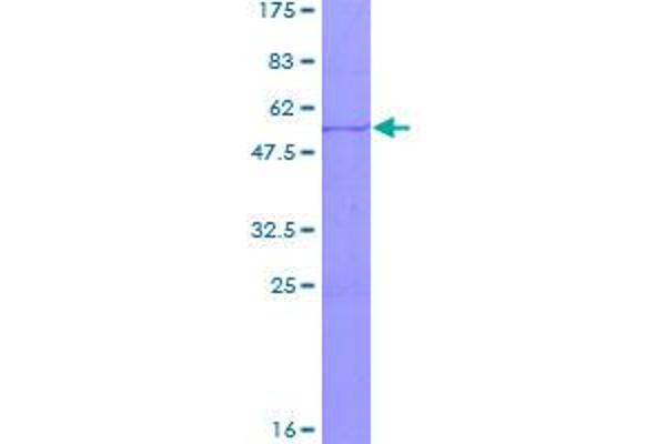 SSX4 Protein (AA 1-188) (GST tag)