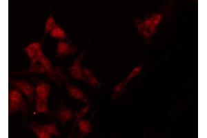 ABIN6267650 staining Hela by IF/ICC. (STAT4 抗体  (pTyr693))
