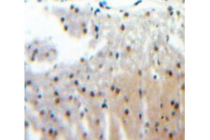 Used in DAB staining on fromalin fixed paraffin-embedded Brain tissue (CENPI 抗体  (AA 321-579))