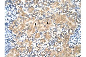 Immunohistochemistry (IHC) image for anti-Tetraspanin 5 (TSPAN5) (Middle Region) antibody (ABIN2782690) (Tetraspanin 5 抗体  (Middle Region))