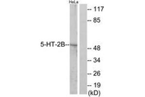 Western Blotting (WB) image for anti-Serotonin Receptor 2B (HTR2B) (AA 261-310) antibody (ABIN2889845) (Serotonin Receptor 2B 抗体  (AA 261-310))