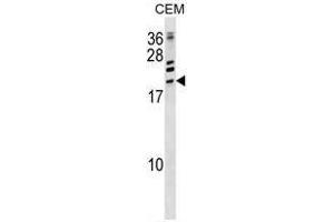 ATF3 Antibody (C-term) western blot analysis in CEM cell line lysates (35ug/lane). (ATF3 抗体  (C-Term))