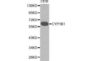Western blot analysis of extracts of CEM cell lines, using CYP1B1 antibody. (CYP1B1 抗体  (AA 1-260))