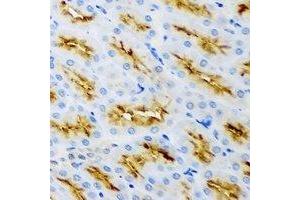 Immunohistochemical analysis of Clathrin Heavy Chain staining in rat kidney formalin fixed paraffin embedded tissue section. (Clathrin Heavy Chain (CLTC) 抗体)