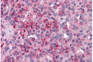 Human Spleen: Formalin-Fixed, Paraffin-Embedded (FFPE) (PAK1 抗体  (AA 245-490))