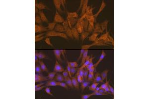 Immunofluorescence (IF) image for anti-Protein Kinase, CAMP Dependent, Catalytic, beta (PRKACB) (AA 1-351) antibody (ABIN6146183)