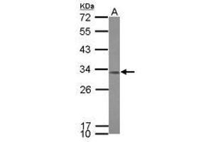 Image no. 1 for anti-Coiled-Coil Domain Containing 44 (CCDC44) (AA 9-105) antibody (ABIN1501284) (TACO1 抗体  (AA 9-105))