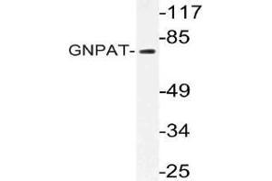 Western blot (WB) analysis of GNPAT antibody in extracts from HT-29 cells. (GNPAT 抗体)