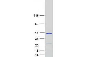 GTPBP10 Protein (Transcript Variant 2) (Myc-DYKDDDDK Tag)